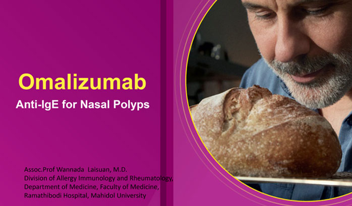 Omalizumab: Anti-IgE for Nasal Polyps